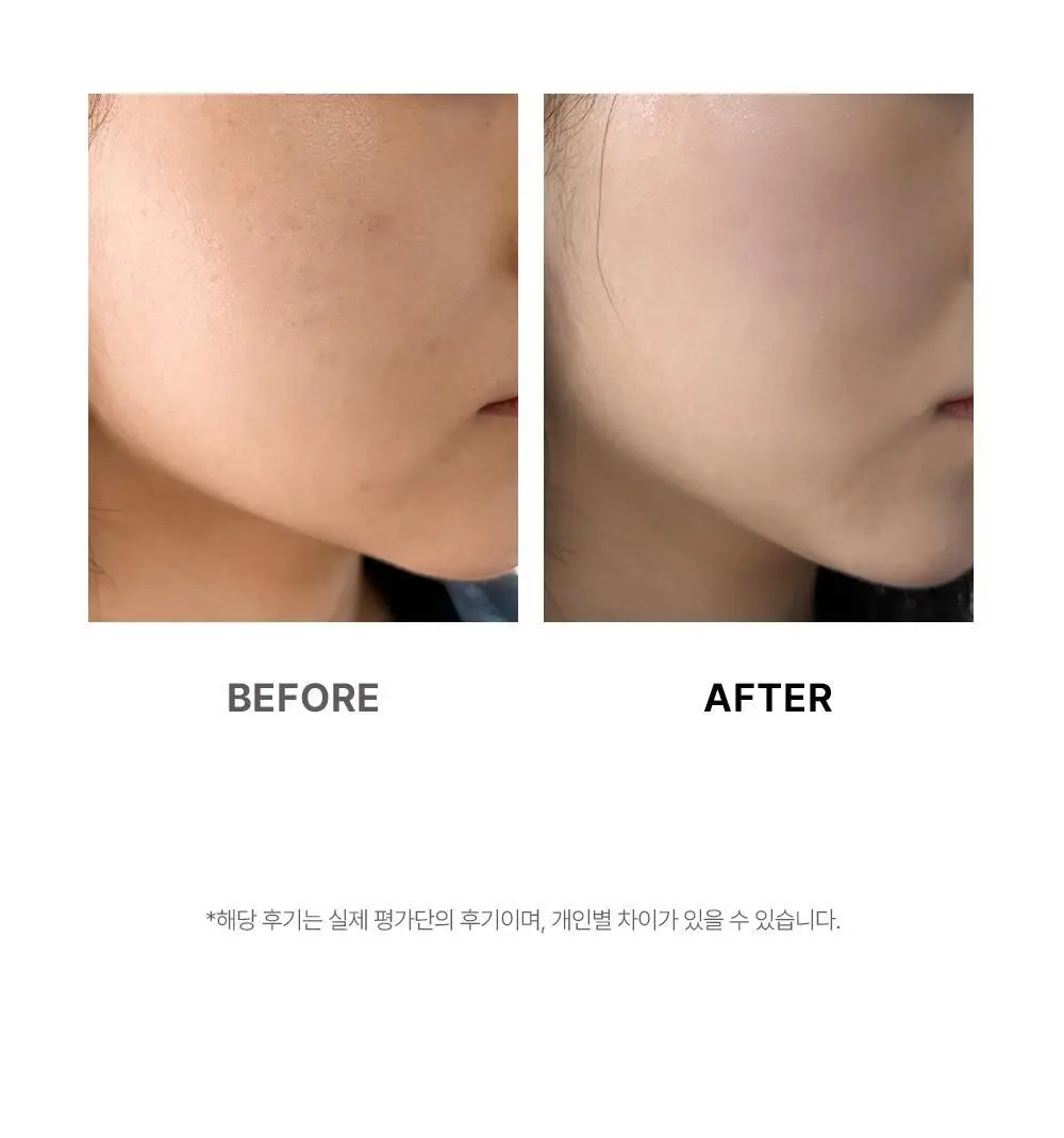 [NEW] 닥터탱글 하이퍼부스터 상세페이지 12